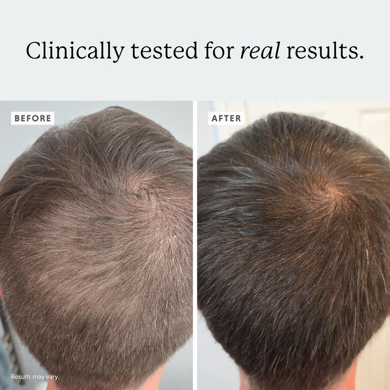 Densifying Scalp Serum